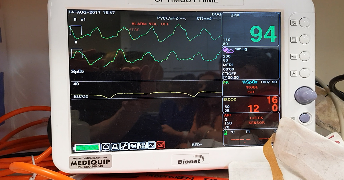 Cardiopulmonary resuscitation, pt 4: monitoring equipment