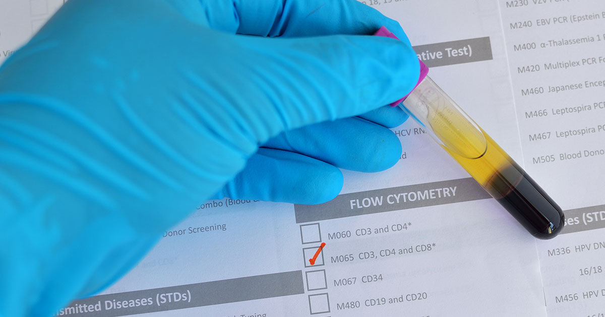 Lymphocytes, part 4: further tests (PARRty time)