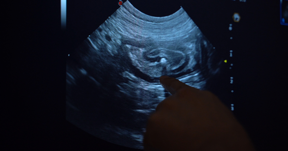 Linear foreign bodies, part 2: tips for diagnosing with ultrasound